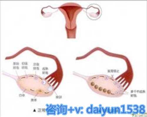 北京供卵试管流程与步骤