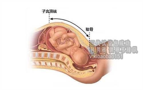 北京供卵的途径_女性去俄罗斯做试管婴儿要哪些条件呢？