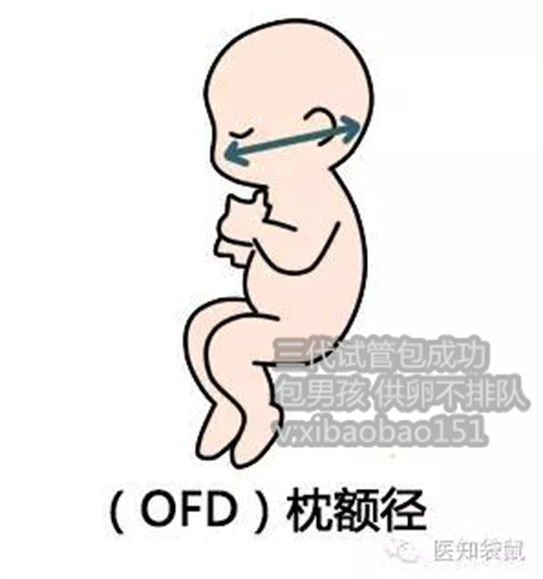 北京助孕QQ号,重庆精子库和成都精子库