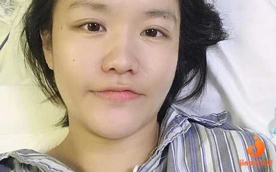 【北京哪家医院可以做供卵试管婴儿】剖腹产女宝，记录一下（下）